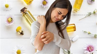 مكونات طبيعية من مطبخك للتقليل من التهيج المصاحب للأكزيما 	