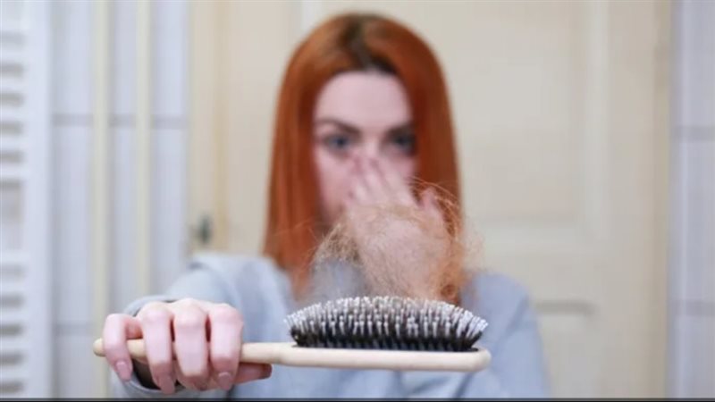  للشعر الأحمر