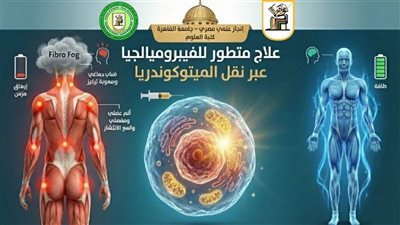 جامعة القاهرة تحقق إنجازًا علميًا عالميًا في علاج مرض الفيبروميالجيا المستعصي