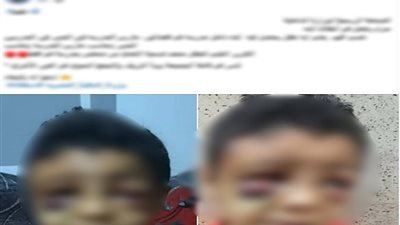 الأمن يكشف حقيقة إصابة طفل في قنا بعد انتشار إدعاءات تعرضه للضرب بالمدرسة