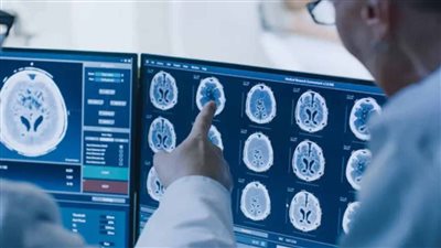 طريقة مبتكرة بالذكاء الاصطناعي تكشف المحفزات الخفية للسرطان