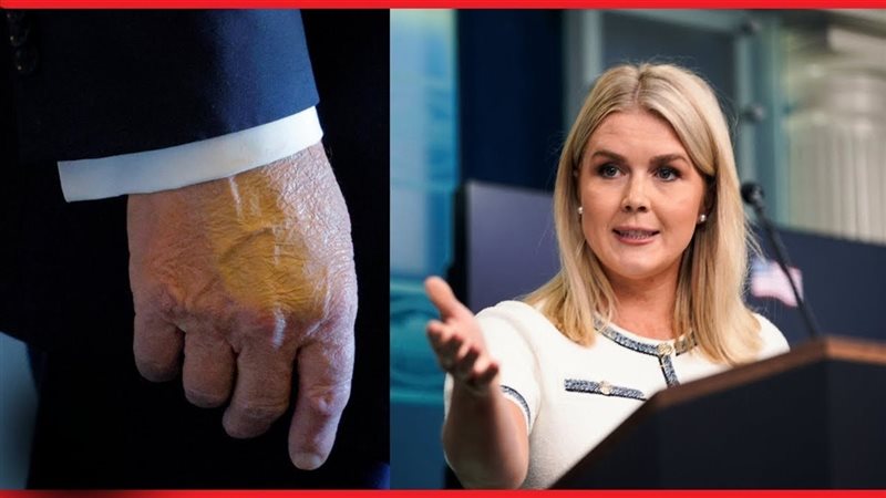 البيت الأبيض وضمادة