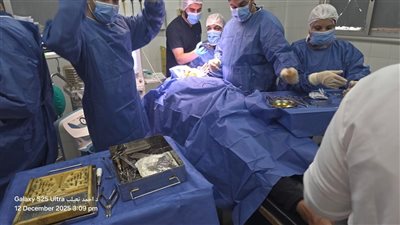  76 عملية في يوم واحد.. إنجاز طبي جديد بمستشفى أشمون للقضاء على قوائم الانتظار