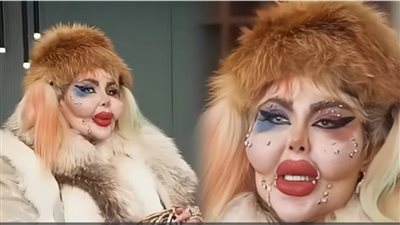 388 عملية تجميل و8 سنوات بلا طعام.. البلوجر أناهيتا ناجو تثير جدل واسع