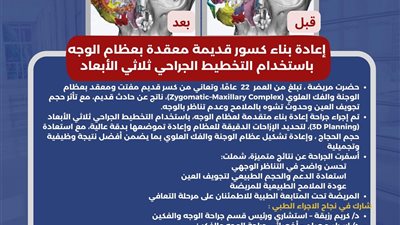 إجراء اول عمليه دقيقة بالوجه والفكين بمستشفى العامرية المركزي 