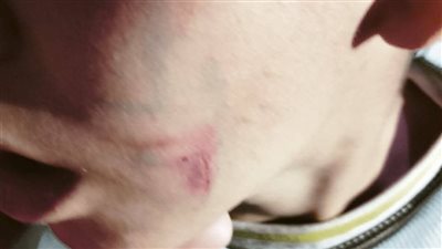 منشور متداول لطفل به أثار ضرب وجروح بعد تعدى معلمة بمركزدروس عليه 