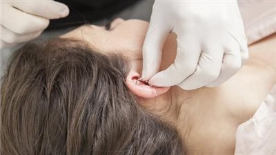 «البيرسينج ».. موضة رائجة تنذر بمشكلات جلدية مزمنة