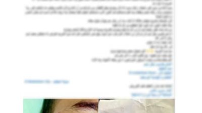 «خبطه وهرب».. ضبط قائد فان صدم طالبًا بالمقطم وفر من موقع الحادث