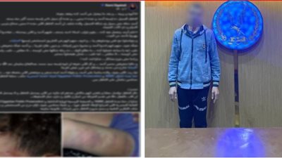 التحقيق فى واقعة تعدي أب على نجله بالضرب و إصابته بإصابات بالغة 