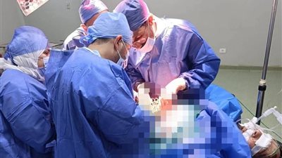إنقاذ حياة مريض من موت محقق إثر تعرضه لحادث سقوط من علو بالشرقية