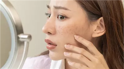 كريمات تفتيح البشرة.. نضارة وتوهج لبشرتك هذا الشتاء 