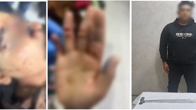 لرفض شقيقها خروجها دون علمه.. الأمن يكشف حقيقة فيديو فتاة مصابة بجروح بالشرقية