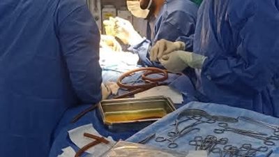 صحة البحيرة نجاح الفريق الطبي فى إجراء عمليتين متقدمتين لطفل وطفلة 