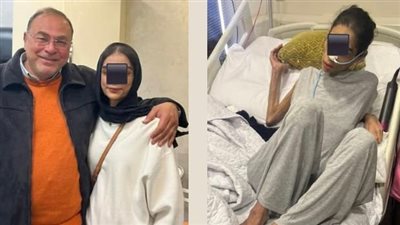 طبيب مصري ينجح في تخليق معدة جديدة وانقاذ فتاة من موت مؤكد