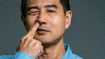 دراسة تحذر: سلوك شائع بالأنف قد يسهل وصول ألزهايمر إلى الدماغ
