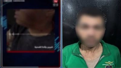 جرح في الوجه وكدمة في الضمير.. التحقيق في واقعة الاعتداء على طالب بمول التجمع 
