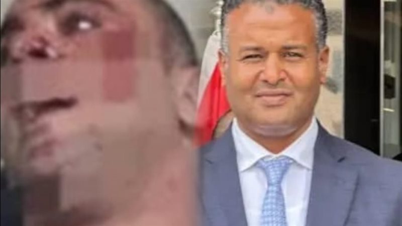 كاميرات المراقبة