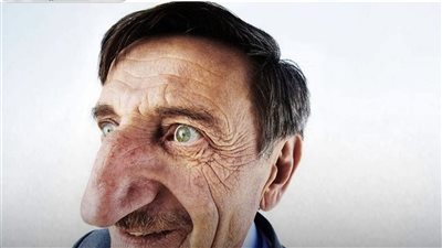 خبراء شائعة: عودة موضة الأنف الكبير في عالم التجميل