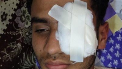 السجن المشدد 10 سنوات لـكوارشي بعد فقد شاب إحدى عينيه في اعتداء عنيف