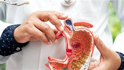 كيف تحمين نفسك من سرطان المعدة؟ عادات يومية تقلل الخطر