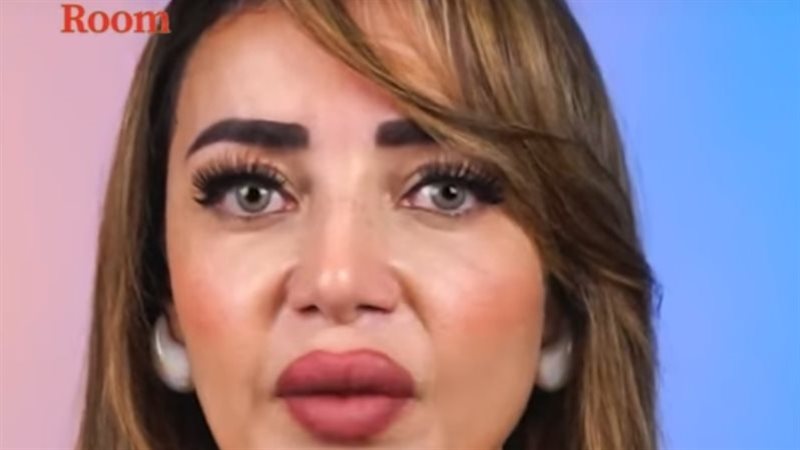 البهاق مرض معد د.هبة