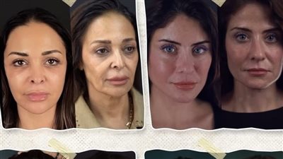 تصل إلي 600 ألف .. كم يبلغ سعر عملية شد الوجه العميق اللاتي تخضع لها النجمات؟