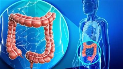 أمل جديد.. علاج سرطان القولون والمستقيم بالذكاء الاصطناعي 