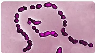 الانتشار السريع لمرض أكل اللحم يثير القلق في الولايات المتحدة