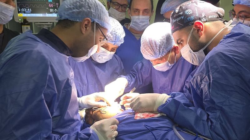 العمليات