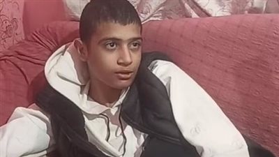 صاحب أول عملية زراعة جلد طبيعي: نجاح العملية بمستشفى أهل مصر منحني الأمل