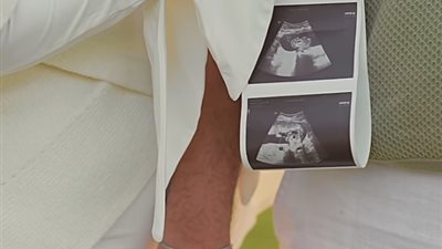 بـ«فيديو وكوتشي وصورة 3D».. ابنة هبة قطب تكشف خبر حملها في عيد الحب