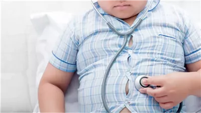 اقتراح برغبة يكشف مفاجأة.. 17% من الأطفال يعانون من السمنة المفرطة