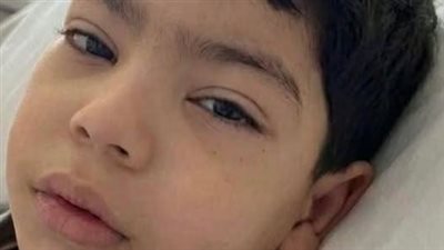 نقلوا عضلة من ظهره لترميم ساقه.. تفاصيل 12 ساعة لإنقاذ طفل باسوس من البتر
