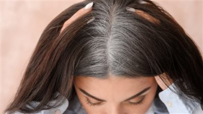 تعرفي على الأسباب العلمية وراء الشيب المرتبط بالضغوط النفسية