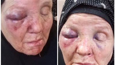 تكرر أكثر من مرة.. سقوط شاب اعتدى على والدته المسنة داخل منزل الأسرة