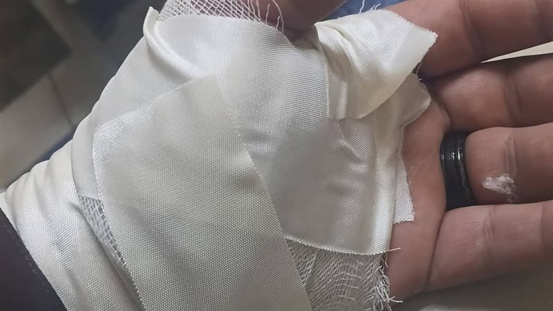 آثار الإصابة 