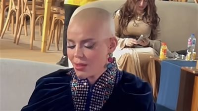 هبة السيسي ليست الأولى.. نجمات ظهرن بدون شعر لأسباب فنية وشخصية 