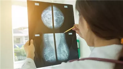 دراسة علمية.. أدوية الخصوبة لا تزيد من خطر الإصابة بسرطان الثدي