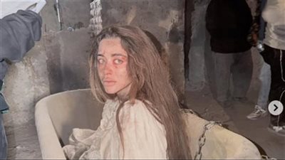 مسلسل علي كلاي الحلقة 23 .. ظهور مفاجئ ليارا السكري بعد الحادث