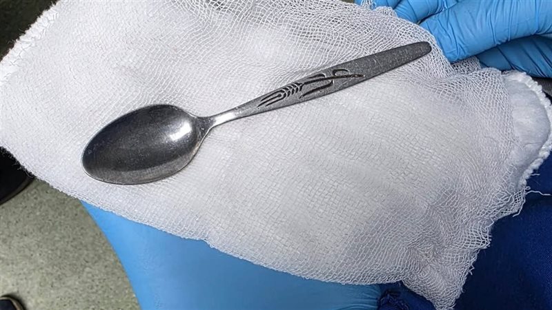 من العملية 