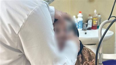 مستشفى جامعة الأزهر بأسيوط تطلق مبادرة للكشف المبكرعن المياه الزرقاء