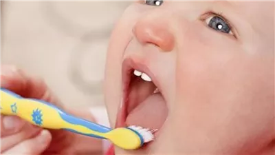 من أول يوم.. خطوات بسيطة تحمي أسنان طفلك من التسوس المبكر