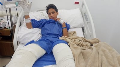 لشراء المخدرات.. شاب يشعل النار في صبي ميكانيكي بطنطا.. والطفل يستغيث