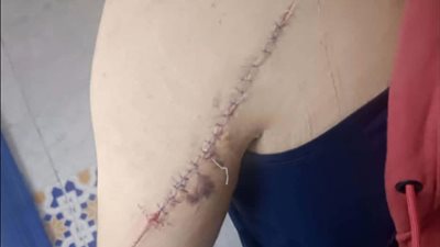 زوجة تهاجم زوجها بسلاح أبيض بالشرقية وتصيبه بجروح بالغة