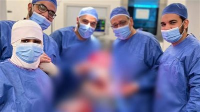 نجاح طبي عالمي بمركز 30 يونيو الدولي: استئصال ورم كلوي يزن 8 كجم بالإسماعيلية