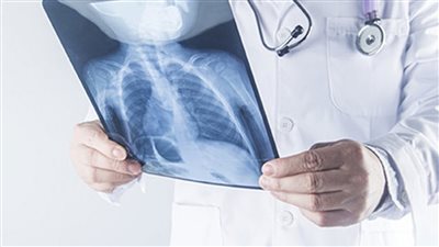 إنجاز غير مسبوق.. تقنية جديدة لتشخيص أمراض الرئة خلال دقائق