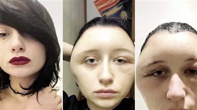 تضاعف حجم رأسها.. فتاة فرنسية تثير الجدل بعد استخدمها صبغة للشعر 