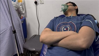  نجاة من الموت في الغربة.. رسالة مؤثرة لشخص تعرض لحريق بسبب شاحن موبايل