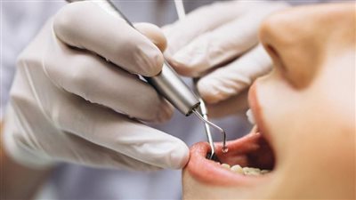 خطوة غير مسبوقة.. تطوير طريقة مبتكرة لتشخيص وعلاج مرض فموي شائع