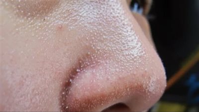     تعانين من الرؤوس البيضاء ؟ هذه الأخطاء تكون السبب